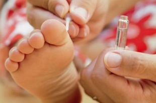 Treatment methods for plantar warts