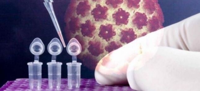 HPV diagnostics with the Digene test